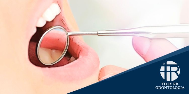 3 doenças “diferentes” que seu dentista pode diagnosticar em uma consulta